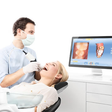 itero dental impressions